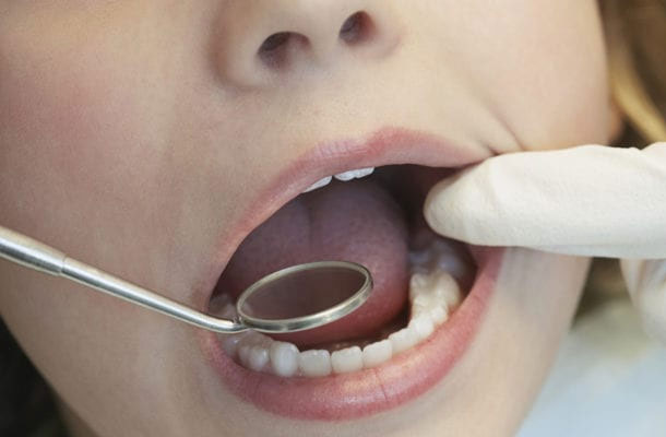 Oral Cancer Facts